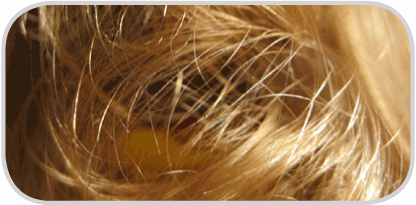 Анализ волос